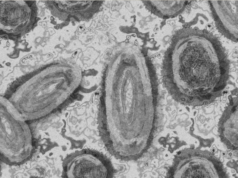 En Puerto Vallarta buscan casos sospechosos de la viruela de mono